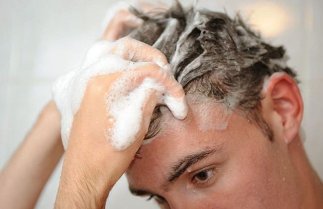 Выпадение волос у мужчин фото 2