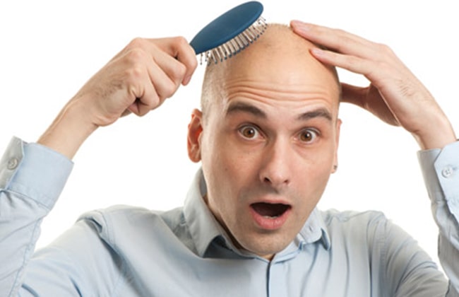 Выпадение волос у мужчин фото 4